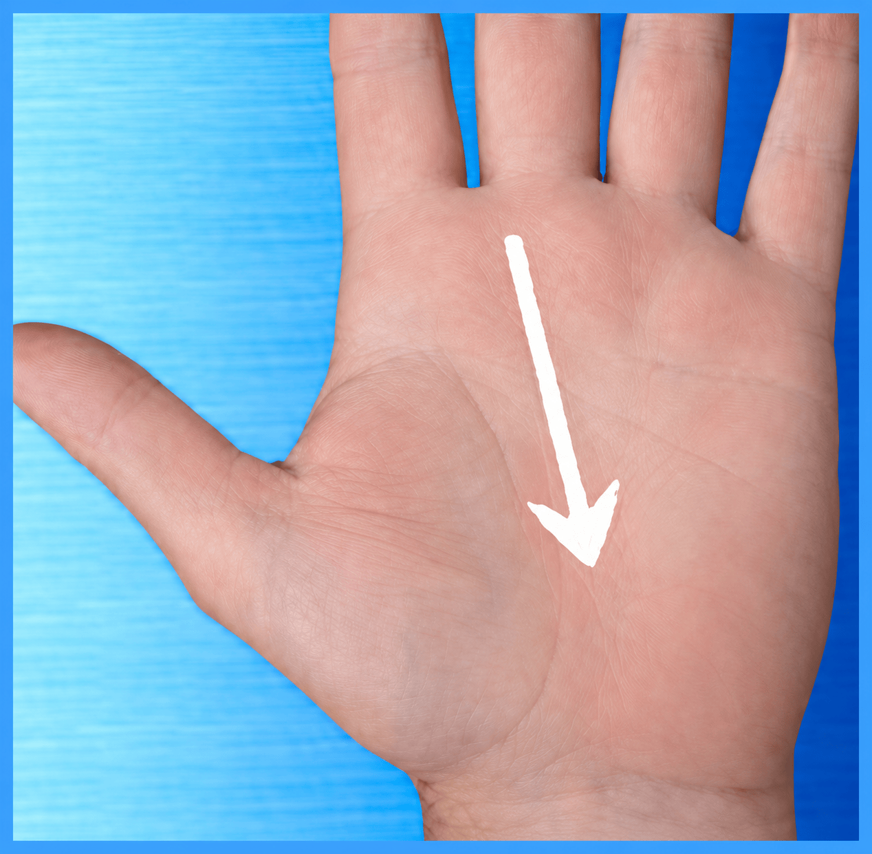 Our No-Stitch carpal tunnel release