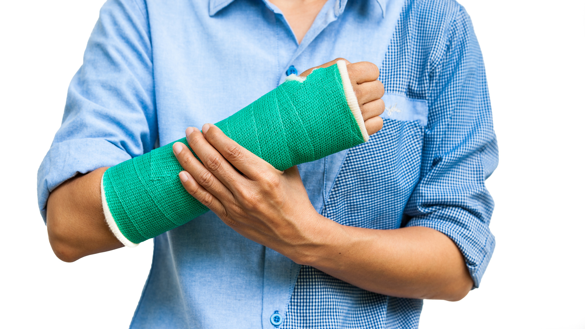 This Is How To Tell If You Have A Broken Arm