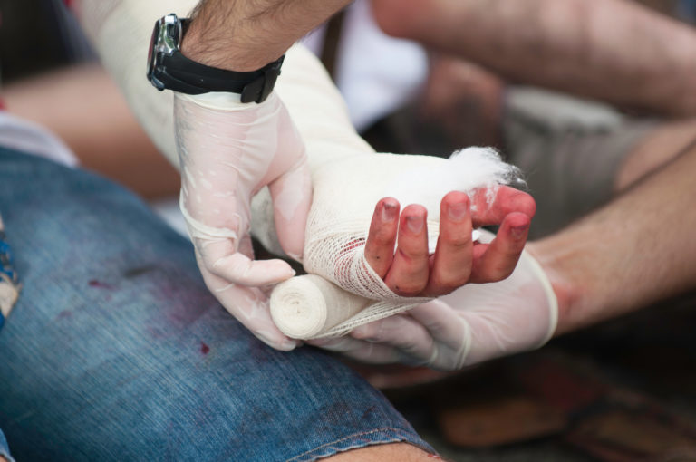 Post Driver Hand Injury 8 Common Hand Injuries for Professional Athletes - HSST